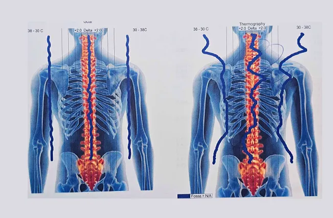 Thermography | Nepute Wellness