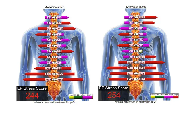 Semg | Nepute Wellness