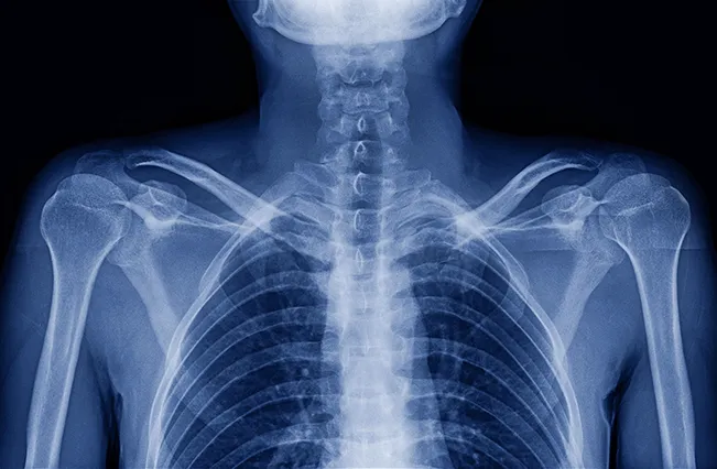 Xray shoulders chest | Nepute Wellness
